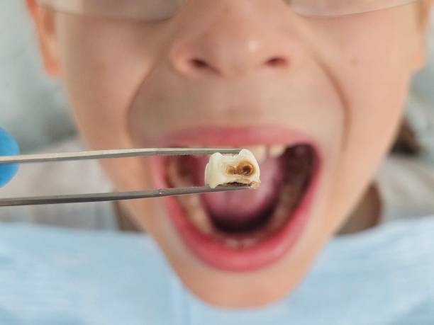 Best Emergency TMJ Treatment in Big Sandy, TX