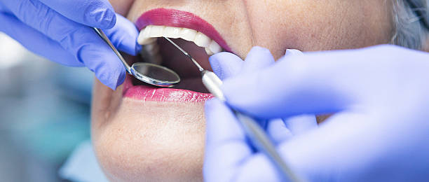 Best Urgent Care for Lost Fillings or Crowns in Big Sandy, TX
